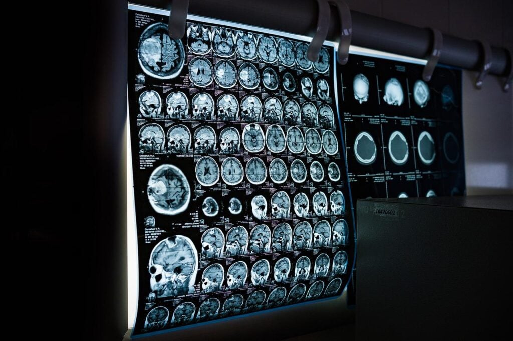 Imagem mostra um painel digital de raio x.